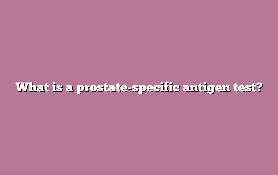 What is a prostate-specific antigen test?